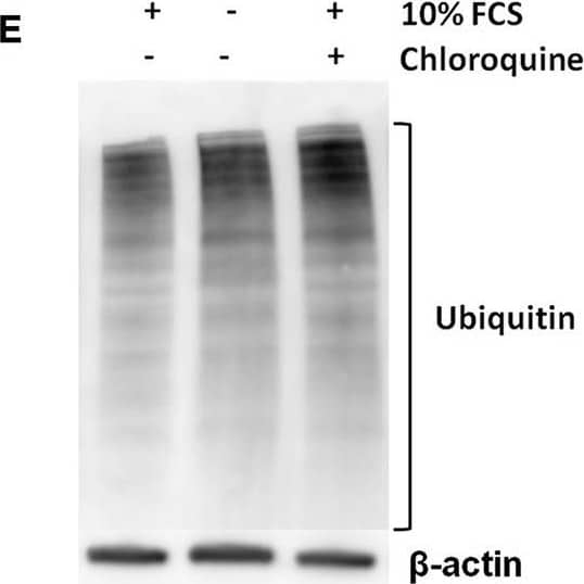 Pro-IL-1 beta  degradation is induced by the autophagy inhibitors chloroquine and bafilomycin A, and by the proteasome activator betulinic acid. (A) Chloroquine selectively attenuates IL-1 beta  release from cardiac fibroblasts. The cells were incubated with LPS and/or 20 μM chloroquine phosphate as indicated for 18 h, then activated with 3 mM ATP for 60 min. IL-1 beta , TNF, MIP-2, and IL-6 were quantified in the conditioned media (n = 3). (B,C) Cardiac fibroblasts were incubated with LPS for 18 h with or without 20 μM chloroquine phosphate and pro-IL-1 beta  quantified with western blot (n = 3). (D) Pro-IL-1 beta  mRNA expression was quantified with qPCR (n = 3). (E,F) Cardiac fibroblasts were incubated with LPS for 20 h with or without 10% FCS or 20 μM chloroquine phosphate as indicated. The amount of total ubiquitinated protein was quantified with western blot (n = 4). (G,H) Cardiac fibroblasts were incubated with 10% FCS with or without 10 ng/mL LPS and/or 100 nM bafilomycin A1 for 20 h. Pro-IL-1 beta  was quantified with western blot. (I,J) Cardiac fibroblasts were incubated with 10% FCS with or without 10 ng/mL LPS and/or 20 μM betulinic acid as indicated for 20 h. Pro-IL-1 beta  was quantified with western blot. All columns are mean with SEM. *p < 0.05, **p < 0.01 (paired student t-test). Image collected and cropped by CiteAb from the following publication (//pubmed.ncbi.nlm.nih.gov/31244838), licensed under a CC-BY license. Not internally tested by R&D Systems.