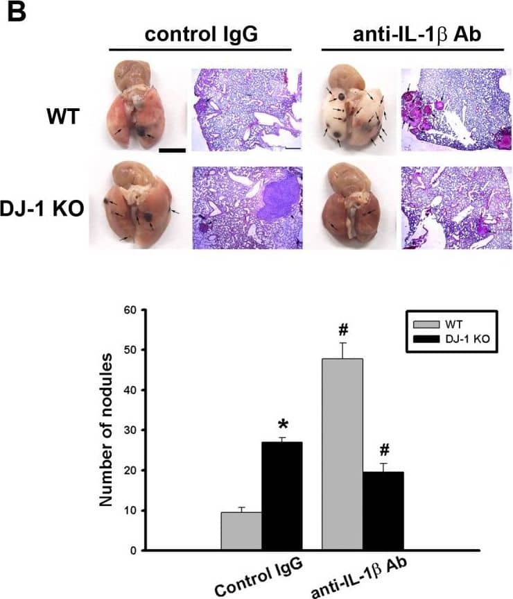 <b>Biological Strategies Validation. </b>Differential effects of IL-1 beta  neutralization on melanoma lung nodules in WT and DJ-1 KO mice.(A) IL-1 beta  antibody (10μg) or control IgG was intravenously injected into mice once. The melanoma cells (6×104) were intravenously injected 30 minutes later. The mice were sacrificed three weeks later. Bar chart showed that the anti-IL-1 beta  neutralizing antibody can effectively lower serum IL-1 beta  levels as compared with control IgG in both WT and DJ-1 KO mice. Note that serum IL-1 beta  levels were higher in DJ-1 KO mice than those in WT mice. (B) Inhibition of IL-1 beta  neutralization on lung nodules formation in DJ-1 KO mice. Upper panels: melanoma nodules in lungs of WT (top) and KO (bottom) mice treated with control IgG (left) or neutralizing anti-IL-1 beta  antibody (right). For each experimental condition, the gross and microscopic morphologies of tumor nodules are indicated by arrows, and are shown at left and right sites, respectively. Scale bars: 0.5 mm for lung photographs and 0.5 mm for H&E staining. Lower panel: Bar chart showed the summarized results of lung nodule numbers in WT and DJ-1 KO mice. Note that IL-1 beta  neutralization enhanced and suppressed melanoma nodules formation in WT and DJ-1 KO mice, respectively. Data are presented as mean ± S.E.M. n = 5 for each group, * p < 0.05 compared with control IgG-treated WT mice, # p<0.05 compared with respective control IgG in WT and DJ-1 KO mice. Image collected and cropped by CiteAb from the following publication (//dx.plos.org/10.1371/journal.pone.0115827), licensed under a CC-BY license. Not internally tested by R&D Systems.