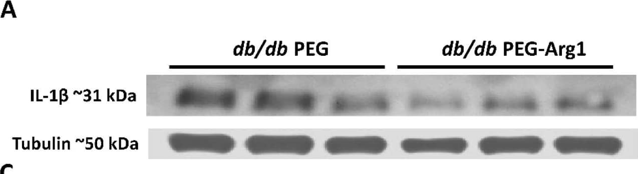 PEG-Arg1 treatment reduced retinal inflammation and reversed MΦ/microglia soma enlargement. (A,C) Representative Western blots of the pro-inflammatory cytokines IL-1 beta  and TNF-  alpha  in retinal protein lysates from PEG-A1-treated db/db mice with quantification (B,D, respectively) compared with the PEG-treated db/db controls (n = 6/group, * p < 0.05, ** p < 0.01). (E) Retinal flat-mounts imaged at the level of the superficial vascular plexus labeled with isolectin B4 (vasculature) and Iba-1 (MΦ/microglia) with Iba-1 in the enlarged inset (boxed in white) showing exceptionally enlarged perivascular MΦ/microglia. (F) Quantification of MΦ/microglia soma size, demonstrating significant size reductions in the db/db mice treated with PEG-Arg1 compared with the vehicle-treated controls (n = 3 mice/group, * p < 0.05). Image collected and cropped by CiteAb from the following open publication (//pubmed.ncbi.nlm.nih.gov/36139465), licensed under a CC-BY license. Not internally tested by R&D Systems.