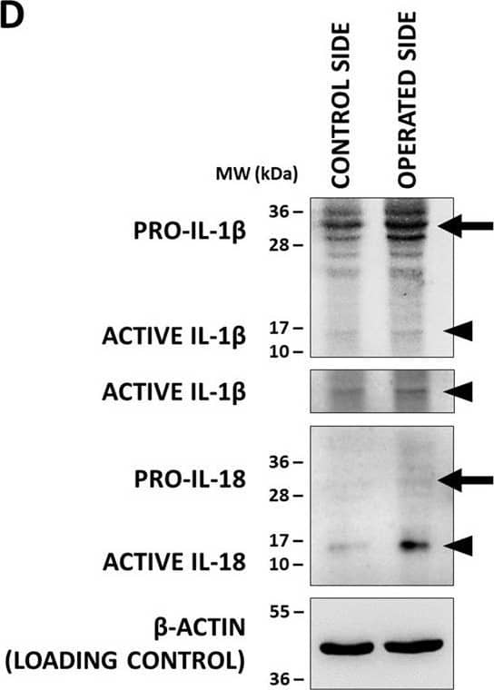 Co-localization of inflammasome components&production of active interleukin-1 beta (IL-1 beta )&IL-18 (IL-18) in the XII. nucleus. (D) Representative WB images of IL-1 beta &IL-18 proteins in of the hypoglossal nuclei after unilateral axotomy of corresponding brain nerve. Arrows indicate pro-forms, arrowheads show active cytokines. Image collected & cropped by CiteAb from the following open publication (//pubmed.ncbi.nlm.nih.gov/33328988), licensed under a CC-BY license. Not internally tested by R&D Systems.