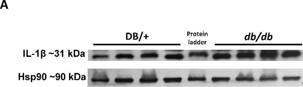 Elevated retinal inflammation and MΦ/microglia soma enlargement in db/db mice. (A) Representative Western blots of IL-1 beta  in retinal protein lysates with quantification in (B), demonstrating significant increases in IL-1 beta  (n = 10) expression in db/db mice compared with the lean DB/+ controls. (C) Retinal flat-mounts imaged at the level of the superficial vascular plexus and labeled with isolectin B4 (vasculature) and Iba-1 (MΦ/microglia). White arrows point to the perivascular macrophages with Iba-1 in the enlarged inset (boxed in white) showing exceptionally enlarged perivascular MΦ/microglia. (D) Quantification of MΦ/microglia soma size, demonstrating a significant size increase in db/db mouse retinas compared with the lean controls (n = 3 mice/genotype, * p < 0.05). Data are presented as the mean ± SEM. Image collected and cropped by CiteAb from the following open publication (//pubmed.ncbi.nlm.nih.gov/36139465), licensed under a CC-BY license. Not internally tested by R&D Systems.