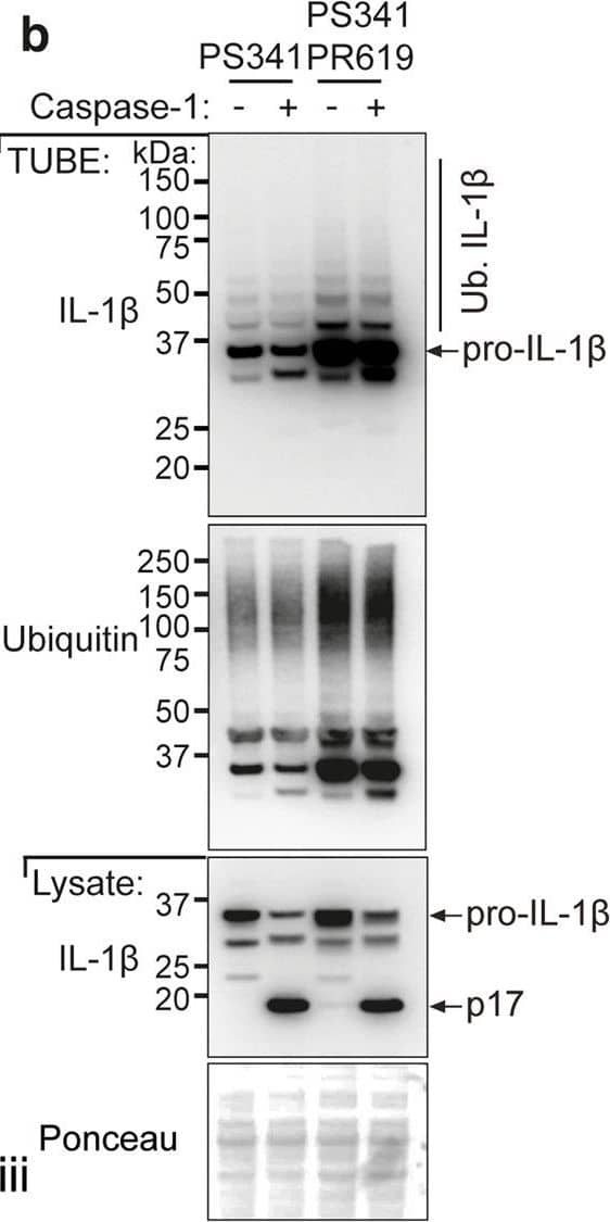 LPS-induced IL-1 beta  is increased in Il1bK133R/K133R mice in vivo.a BMDMs derived from mice of the indicated genotypes were treated with LPS (100 ng/ml) for 3 h, followed by proteasome inhibition (PS341, 10 μM) for an additional 3 h. Biotin conjugated IL-1 beta  antibody was used to purify IL-1 beta  from cell lysates and its modification analyzed using the indicated ubiquitin (Ub) chain-specific antibodies. Cell lysates from the same experiment were run in triplicate with roman numerals on the bottom right of the blots indicating the membrane probed. One of two independent experiments. b BMDMs were primed with LPS (100 ng/ml) for 3 h followed by treatment for a further 3 h with PS341 (10 μM). Cells were subsequently lysed in buffer containing either PS341 (10 μM), or PS341 and PR619 (10 μM), as indicated. Recombinant caspase-1 (5 Units) was added and cell lysates incubated at 37 °C for 80 min. Subsequently, ubiquitylated proteins were purified by Tandem Ubiquitin Binding Entities (TUBEs) and analyzed by immunoblot. One of two independent experiments. c–f WT and Il1bK133R/K133R mice were injected intra-peritoneally with 100 μg of LPS. After 2 h serum and peritoneal fluid was harvested and analyzed by ELISA for levels of c IL-1 beta , d TNF, and e IL-6. Data are mean ± SEM, symbols represent individual mice, n ≥ 19 mice/genotype from three pooled independent experiments for c, d and n ≥ 14 for e from 2 to 3 pooled experiments. P-values were calculated using an unpaired two-tailed t-test for comparisons between genotypes. f Peritoneal fluid was analyzed by immunoblot for the indicated proteins. Each lane represents an individual mouse. n = 5–6 mice per genotype. One of two independent experiments (analysis of nine additional WT and 19 Il1bK133R/K133R mice are shown in Supplementary Fig. 7b). Image collected and cropped by CiteAb from the following open publication (//pubmed.ncbi.nlm.nih.gov/33976225), licensed under a CC-BY license. Not internally tested by R&D Systems.