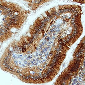 IL‑1 beta /IL‑1F2 was detected in perfusion fixed paraffin-embedded sections of Mouse Intestine using Goat Anti-Mouse IL‑1 beta /IL‑1F2 Antigen Affinity-purified Polyclonal Antibody (Catalog # AF-401-NA) at 5 &micro;g/mL for 1 hour at room temperature followed by incubation with the Anti-Sheep IgG VisUCyte&trade; HRP Polymer Antibody (VC006). Before incubation with the primary antibody, tissue was subjected to heat-induced epitope retrieval using VisUCyte Antigen Retrieval Reagent-Basic (VCTS021). Tissue was stained using DAB (brown) and counterstained with hematoxylin (blue). Specific staining was localized to cytoplasm in epithelial cells. View our protocol for IHC Staining with VisUCyte HRP Polymer Detection Reagents.