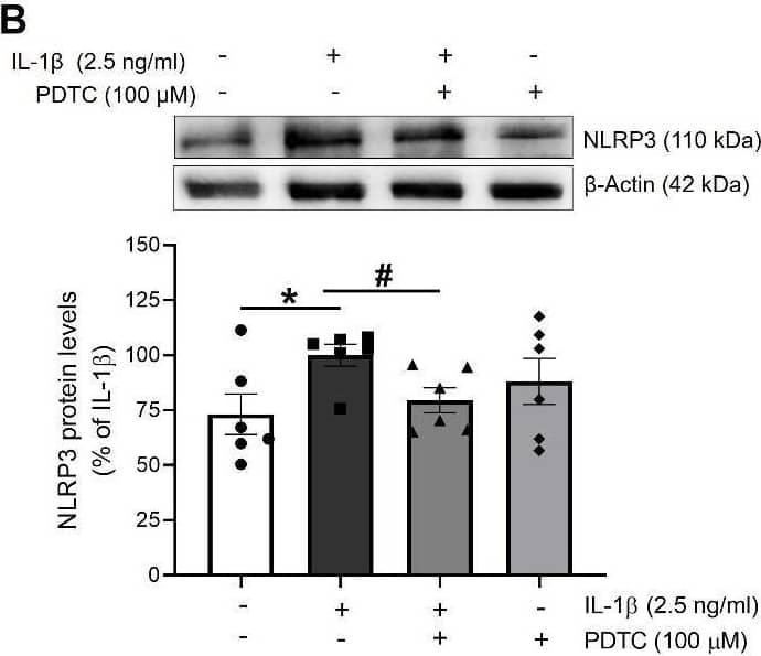 The activation of NLRP3 by IL-1 beta  is mediated by NF-kappa B. The expression of (A) phosphorylated p65 (p-p65) and total p65 (p65), used as a marker of NF-kappa B activation, and the NLRP3 inflammasome components (B) NLRP3, (C) pro-IL-1 beta  and (D) mature IL-1 beta  levels was determined by Western blot in total lysates from HUVEC stimulated for 18 h with IL-1 beta  in presence or absence of PDTC (100 µM). Representative blots are shown on top of the corresponding graphs, where  beta -Actin was employed as loading control (n= 5-7; *p<0.05 vs. untreated cells; #p<0.05 vs. IL-1 beta -treated cells, by two-way ANOVA and Tukey post-hoc test). All data are shown as mean ± SEM and expressed as percentage of IL-1 beta -induced levels. Image collected and cropped by CiteAb from the following open publication (//pubmed.ncbi.nlm.nih.gov/35111374), licensed under a CC-BY license. Not internally tested by R&D Systems.
