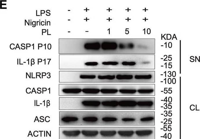 PL dose-dependently inhibits nigericin-induced NLRP3 inflammasome activation. (A) Cell viability of PL (1–40 μM) in peritoneal macrophages. (B–D) ELISA of IL-1 beta  (B), TNF-alpha  (C), and release of LDH (D) in supernatants from LPS-primed mouse peritoneal macrophages treated with 1–10 μM PL and stimulated with nigericin. (E) Immunoblot of supernatants or cell lysates from LPS-primed mouse peritoneal macrophages treated with 1–10 μM PL and stimulated with nigericin. All data were representative of three independent experiments. Values shown are mean ± SD. For statistical analysis, A–D were analyzed using one-way ANOVA and the Bonferroni test. *p < 0.05; **p < 0.01; ***p < 0.001. Image collected and cropped by CiteAb from the following open publication (//pubmed.ncbi.nlm.nih.gov/35095532), licensed under a CC-BY license. Not internally tested by R&D Systems.