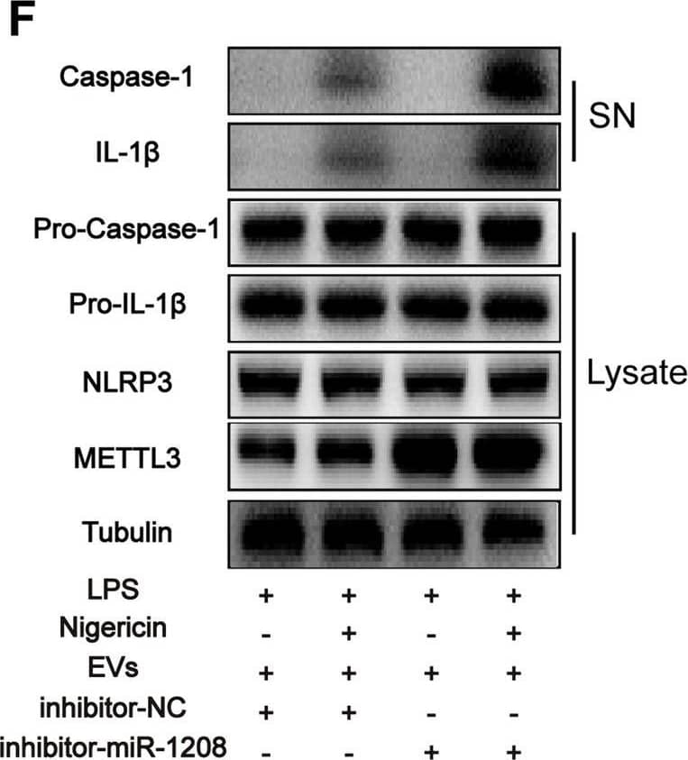 miR-1208 is the key miRNA bind to METTL3 in EVs to exert anti-inflammatory effects. A. Western blot analysis of Ago-2 expression in hucMSCs lysates. B. Western blot analysis of IL-1 beta  and cleaved caspase-1 levels in culture SN and pro-IL-1 beta , pro-caspase-1, NLRP3, and METTL3 levels in macrophage cell lysates in each group. C. Heat map of miRNA levels in hucMSCs-EVs (n = 3, Student’s t test). D. Four most significantly upregulated miRNAs in hucMSCs-EVs. E. The target sequence of miR-1208 estimated within 3′-UTR of METTL3. F. Western blot analysis of IL-1 beta  and cleaved caspase-1 levels in culture SN and pro-IL-1 beta , pro-caspase-1, NLRP3, and METTL3 levels in macrophage cell lysates in each group. G. Luciferase reporter assay showing that METTL3 is the target gene for miR-1208 (n = 3, Student’s t test) Image collected and cropped by CiteAb from the following open publication (//pubmed.ncbi.nlm.nih.gov/35842714), licensed under a CC-BY license. Not internally tested by R&D Systems.