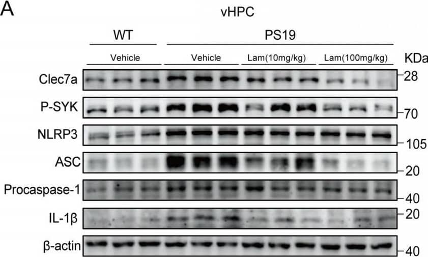 Inhibition of Clec7a effectively mitigates microglial synaptic phagocytosis and neuroinflammation in PS19 mice. (A) Representative Western blots of indicated proteins in the ventral hippocampal lysates from 6-month-old WT mice and Laminarin-administered PS19 mice. (B) Quantitation of Clec7a, P-SYK, NLRP3, ASC, Procaspase-1, and IL-1 beta  proteins in (A) (n = 6 mice per group, unpaired Student’s t test). (C) Representative Western blots of indicated proteins in the ventral hippocampal lysates from 6-months old WT mice and Laminarin-administered PS19 mice. (D,E) Quantitation of PSD95 (D) and synaptophysin (E) proteins (n = 6 mice per group, unpaired Student’s t test). (F) Confocal images of synaptic puncta engulfed by microglia showing the colocalization of PSD95 (green) with CD68 (grays) within Iba1+ microglia (red) in the DG regions of hippocampal tissue from WT mice and Laminarin-administered PS19 mice. Scale bars, 5 μm. (G) Quantitation of CD68 volume. (H) Quantitation of PSD95 engulfment within CD68+ microglial structures (n = 6 mice per group, one-way ANOVA test). * p < 0.05; ** p < 0.01; *** p < 0.001. Data are presented as mean ± SD. Image collected and cropped by CiteAb from the following open publication (//pubmed.ncbi.nlm.nih.gov/40243488), licensed under a CC-BY license. Not internally tested by R&D Systems.