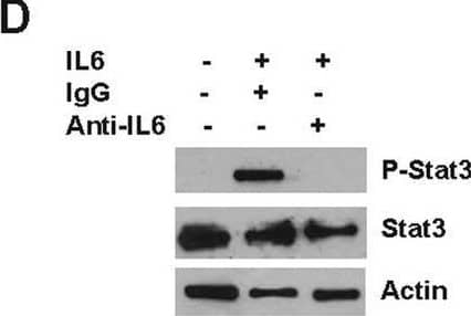 EphA2‐Dependent tumor induction of osteoclast differentiation requires IL‐6. (A) ELISA analysis for IL‐6 protein levels in conditioned media harvested from  4T1. delta C cells relative to 4T1.V controls (p < 0.05, Mann–Whitney test). (B) Graph shows the % tartrate‐resistant acid phosphatase (TRAP)+ osteoclasts in indirect cocultures of osteoclast progenitors with  4T1.V + IgG, 4T1.V + anti‐mouse IL‐6 neutralizing antibody,  4T1. delta C + PBS, and  4T1. delta C + recombinant murine IL‐6. (p < 0.05, Mann–Whitney test). (C) Graph shows the % TRAP+ osteoclasts in direct cocultures of osteoclast progenitors with 4T1.V + IgG,  4T1.V + anti‐mouse IL‐6 neutralizing antibody,  4T1. delta C + PBS, and  4T1. delta C + recombinant murine IL‐6, (p < 0.05, Mann–Whitney test). There were five to eight fields per condition from three independent experiments. (D) Immunoblots show phosphorylated Stat3 levels in osteoclast progenitor cells treated with IL‐6 in the presence or absence of neutralizing anti‐mouse IL‐6 antibody. Uniform loading was confirmed by probing blots for total Stat3 and actin. Image collected and cropped by CiteAb from the following open publication (//pubmed.ncbi.nlm.nih.gov/33869989), licensed under a CC-BY license. Not internally tested by R&D Systems.