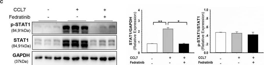 Western Blot CCL7/MCP-3/MARC Antibody [Unconjugated]