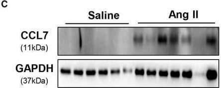 CCL7 expression and macrophages infiltration increased in Ang II‐infused abdominal aortas. (A) Representative abdominal aorta images with ultrasound examination, the maximum abdominal aorta diameter (luminal diameter) and the maximum abdominal aorta area (luminal area). A grid on the scale represented 0.5 mm. (B) qRT‐PCR for CCL7 mRNA expression in saline (n = 6) and Ang II (n = 7) infused mice. (C) Protein levels of CCL7 in saline (n = 6) and Ang II (n = 7) infused abdominal aortas. (D) Plasma concentrations of CCL7 in saline (n = 6) and Ang II (n = 9) infused mice. (E) Representative images of macrophage infiltration in aneurysmal lesions as revealed by CD68 immunostaining. Black arrows indicated CD68‐positive location, scale bars represented 200 μm (left) and 50 μm (right images). Values were represented as mean ± SEM; Student's t test was used for data analysis in (A‐E). *P < .05; **P < .01; ***P < .001, respectively Image collected and cropped by CiteAb from the following open publication (//pubmed.ncbi.nlm.nih.gov/34189838), licensed under a CC-BY license. Not internally tested by R&D Systems.