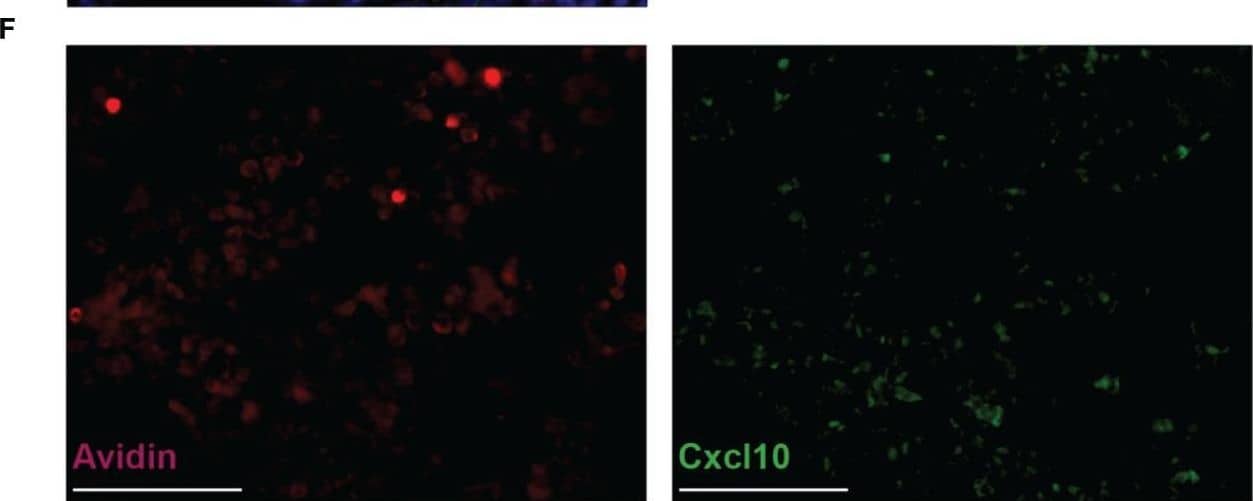 Correlations between neutrophil/mast cell numbers and CXCL10 expression in the fracture hematoma during the early inflammatory phase. Correlation analysis by simple linear regression was performed between the parameters neutrophil numbers, mast cell numbers and local CXCL10 protein expression in all samples. (A) Neutrophil number/CXCL10 correlation. (B) Mast cell number/CXCL10 correlation. (C) Mast cell number/neutrophil number correlation. (D) Immunofluoresence double staining for mast cells (Avidin staining, red) and CXCL10 (green). DNA was counterstained with Hoechst (blue). Scale bar = 50 µm. E) Black box marked the area which is shown in (E). (F) Single fluorescent channels for Avidin (red) and CXCL10 (green). Scale bar = 50 µm. Image collected and cropped by CiteAb from the following open publication (//pubmed.ncbi.nlm.nih.gov/36761764), licensed under a CC-BY license. Not internally tested by R&D Systems.