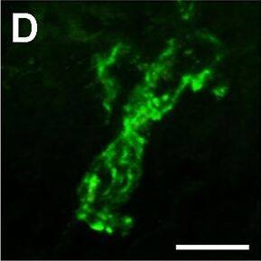 Spatiotemporal analysis of retinal Il-1 beta  protein levels following LD.A-G: Immunohistochemical assessment of Il-1 beta  expression (green) in retinal cryosections over the course of LD. A: Immunoreactivity (IR) for Il-1 beta  protein was not observed in dim-reared animals. B-D: Il-1 beta -IR was present among ramified nuclei situated within the ONL and OS (arrowheads) immediately following exposure to 24hrs LD. E-F: Il-1 beta -IR co-localised with IBA1+ cells (red) situated in the ONL/OS, though was not apparent in IBA1+ cells outside the vicinity of the ONL (asterisks). G-H: Il-1 beta -expressing cells (H, arrowheads) did not show any discernible IR for the M2 marker CD206 (red). I: Negative control sections, in which the primary antibody was omitted, did not show any resemblance to the IR for Il-1 beta  evidenced in C-D at 24hrs LD. J: ELISA for Il-1 beta  protein indicated an increased abundance of the protein immediately after 24hrs LD (P<0.05), and which was virtually undetectable at all other time points. C, choroid; GCL, ganglion cell layer; INL, inner nuclear layer; IHC, immunohistochemistry; ONL, outer nuclear layer; OS, outer segments; RPE, retinal pigment epithelium. The trend in ELISA protein levels was significant by ANOVA (P < 0.05); N = 3 for each timepoint. Image collected and cropped by CiteAb from the following open publication (//pubmed.ncbi.nlm.nih.gov/26630454), licensed under a CC-BY license. Not internally tested by R&D Systems.