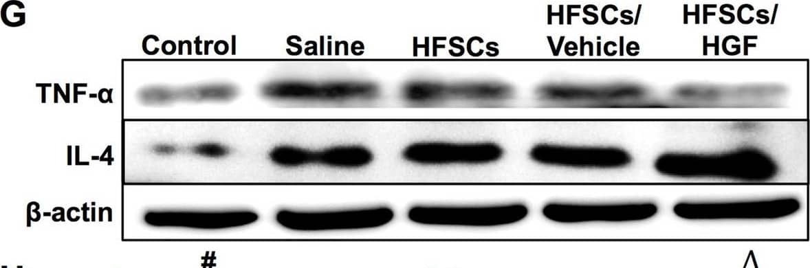 HFSCs and HFSCs/HGF suppressed inflammatory reaction. A–E Iba-1 staining in the penumbra at 7 days after cell transplantation. Scale bar = 100 µm. F The quantitative analysis of the numbers of Iba-1-positive cells. G Representative western blot bands of inflammation-related proteins in different groups. H and I Quantification of TNF-a and IL-4 expression in the ischemic hemisphere extracts. Values are the mean ± SD. *P < 0.05 Saline group vs. Control group, #P < 0.05 HFSCs group vs. Saline group, ∆P < 0.05 HFSCs/HGF group vs. HFSCs/Vehicle group, n = 6 Image collected and cropped by CiteAb from the following open publication (//pubmed.ncbi.nlm.nih.gov/36782269), licensed under a CC-BY license. Not internally tested by R&D Systems.