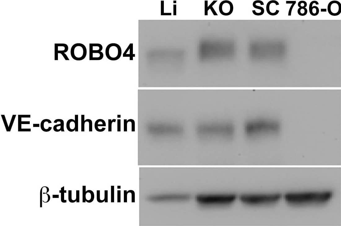 Endogenous ROBO4 upregulation despite lower vascular density in orthotopic and xenograft tumors.A. Immunofluorescence of the vascular endothelium in liver (upper panel) and 786-O human renal cell carcinoma (RCC) subcutaneous xenograft tumor (lower panel). B. Vascular area analysis of liver (Li), kidney orthotopic (KO) tumors, and subcutaneous (SC) xenograft tumors (n = 6 mice analyzed). C. Immunoblot of endogenous ROBO4 and the endothelial cell specific VE-cadherin from liver, kidney orthotopic and subcutaneous xenograft 786-O RCC tumors, and from the derivative 786-O cells grown in culture. D. Densitometry analysis of VE-cadherin/tubulin ratio from C mirrors the vascular area determination in B. E. Densitometry analysis of endogenous ROBO4 normalized to VE-cadherin expression reveals a 1.4- to 2-fold increase in SC and KO tumors compared to liver. C–E: Immunoblot and densitometry was repeated twice with two independent sets of protein extracts from two different tumor-bearing mice with essentially the same results. A. Magnification: 100X, Red: endomucin/CD31 antibody cocktail, Blue: DAPI. B. *p<0.05, one way ANOVA with Tukey's correction, mean ± SD. Image collected and cropped by CiteAb from the following publication (//pubmed.ncbi.nlm.nih.gov/24376772), licensed under a CC-BY license. Not internally tested by R&D Systems.