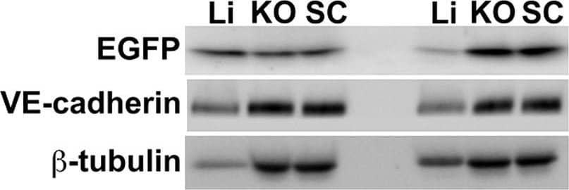 Warfarin pretreatment enhances tumor Ad5ROBO4 vector expression.A. Multiorgan immunoblot of vehicle (left lanes) or warfarin (right lanes) pretreated Rag2−/− mice injected with 1.0×1011 vp of Ad5ROBO4. B. Densitometry of A revealed that vehicle pretreatment was associated with robust liver, detectable splenic, and trace to undetectable expression in all other sampled organs. Warfarin pretreatment produced a 2.5-fold increased splenic and a 3-fold decreased liver expression while all other organs still evidenced trace to undetectable expression. C. Immunoblot and densitometry of liver and tumor EGFP, VE-cadherin, and  beta -tubulin expression in vehicle (left lanes) or warfarin (right lanes) from the same pretreated, Ad5ROBO4-injected mice as in A and B. EGFP densitometry normalized to VE-cadherin, revealed a 4.7-fold decrease in liver and 2-fold increase in increase KO and SC tumor expression produced by warfarin pretreatment. A–C: representative immunoblots from n = 2 mice from 2 independent experiments. Image collected and cropped by CiteAb from the following publication (//pubmed.ncbi.nlm.nih.gov/24376772), licensed under a CC-BY license. Not internally tested by R&D Systems.