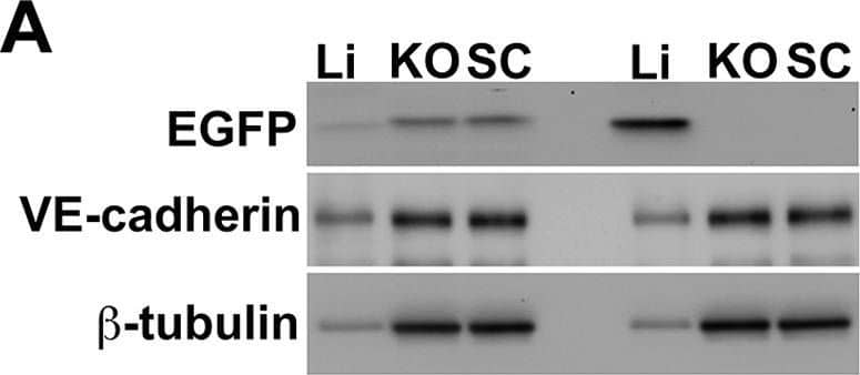 Semiquantitative immunoblotting reveals differential Ad5ROBO4 reporter expression in tumor compared to liver.A. Immunoblot of EGFP, VE-cadherin, and  beta -tubulin loading controls in tissue protein extracts from hCAR:Rag2−/− mice injected with either Ad5ROBO4, left three lanes, or Ad5CMV, right three lanes. B. and C. Densitometry analysis of Ad5ROBO4 vector EGFP expression normalized to either VE-cadherin or  beta -tubulin. D. Densitometry of AdCMV vector EGFP expression. As AdCMV expression was hepatocyte specific, this blot was only normalized to  beta -tubulin. A–D: Representative immunoblots from n = 4 mice injected with either Ad5ROBO 4 or Ad5CMV vectors. Li: liver, KO: kidney orthotopic tumor, SC: subcutaneous tumor. Image collected and cropped by CiteAb from the following publication (//pubmed.ncbi.nlm.nih.gov/24376772), licensed under a CC-BY license. Not internally tested by R&D Systems.