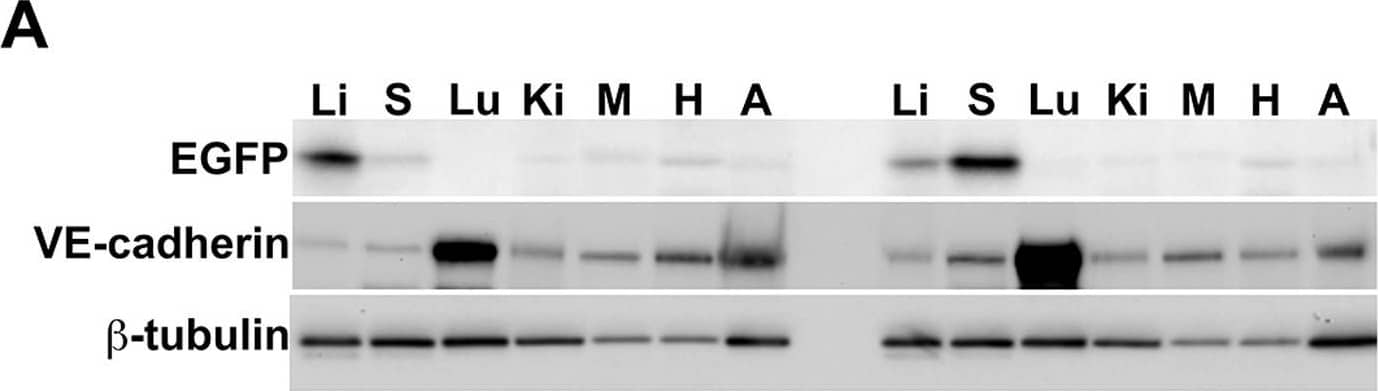 Warfarin pretreatment enhances tumor Ad5ROBO4 vector expression.A. Multiorgan immunoblot of vehicle (left lanes) or warfarin (right lanes) pretreated Rag2−/− mice injected with 1.0×1011 vp of Ad5ROBO4. B. Densitometry of A revealed that vehicle pretreatment was associated with robust liver, detectable splenic, and trace to undetectable expression in all other sampled organs. Warfarin pretreatment produced a 2.5-fold increased splenic and a 3-fold decreased liver expression while all other organs still evidenced trace to undetectable expression. C. Immunoblot and densitometry of liver and tumor EGFP, VE-cadherin, and  beta -tubulin expression in vehicle (left lanes) or warfarin (right lanes) from the same pretreated, Ad5ROBO4-injected mice as in A and B. EGFP densitometry normalized to VE-cadherin, revealed a 4.7-fold decrease in liver and 2-fold increase in increase KO and SC tumor expression produced by warfarin pretreatment. A–C: representative immunoblots from n = 2 mice from 2 independent experiments. Image collected and cropped by CiteAb from the following publication (//pubmed.ncbi.nlm.nih.gov/24376772), licensed under a CC-BY license. Not internally tested by R&D Systems.