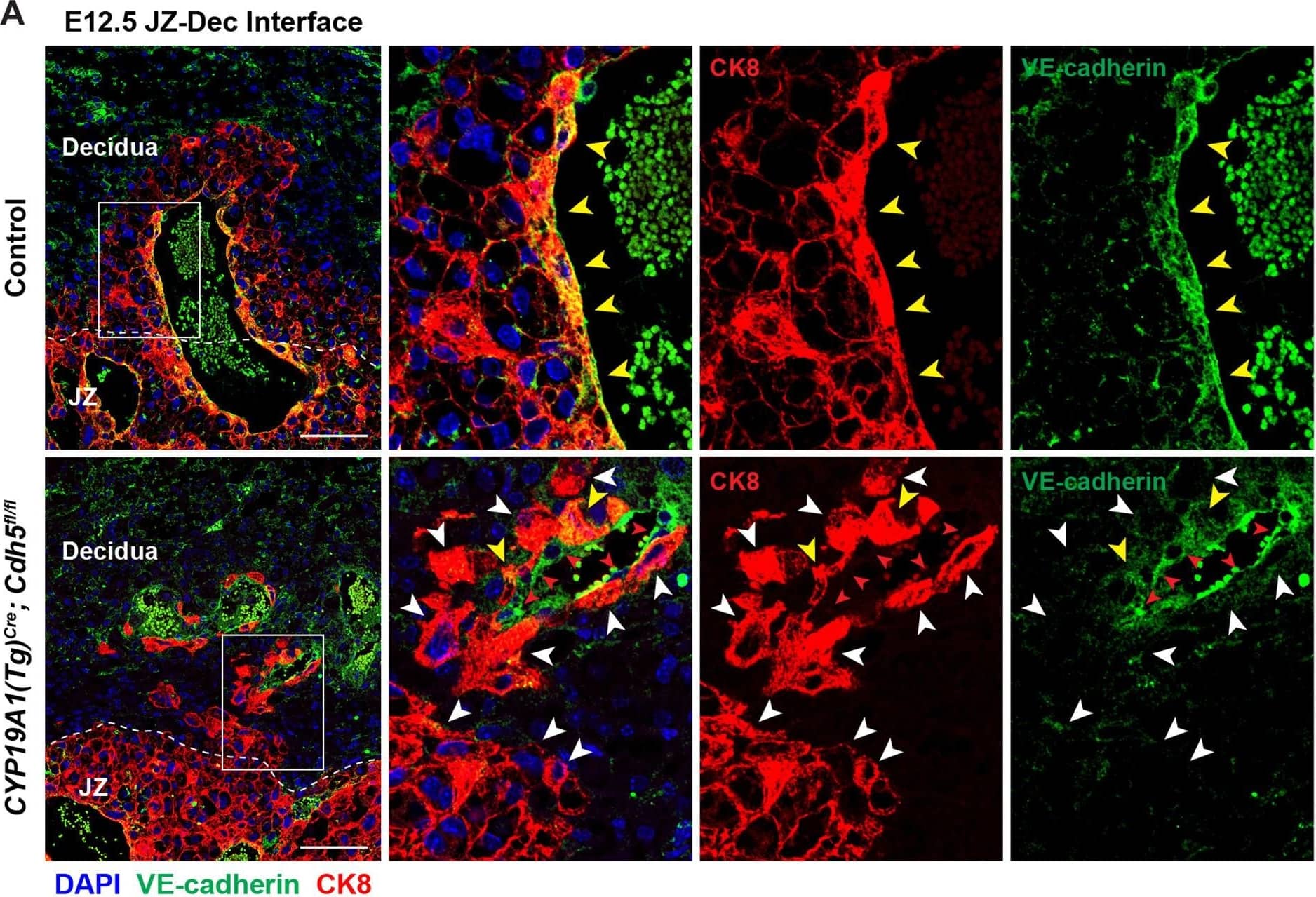 Deletion of VE-cadherin in CYP19A1(Tg)Cre; Cdh5fl/fl placentas.(A, B) Immunofluorescence staining and quantification of E12.5 Control and CYP19A1(Tg)Cre; Cdh5fl/fl placentas for VE-cadherin (green) and CK8 (red). Yellow arrowheads indicate VE-cadherin+ trophoblasts, which predominantly line remodeled spiral arteries. White arrowheads indicate VE-cadherin- trophoblasts. Red arrowheads indicate spiral artery endothelial cells (ECs), which are VE-cadherin+ CK8-. VE-cadherin and CK8 colocalized area was divided by total CK8-positive area to determine the extent of VE-cadherin deletion. Note that there are a few VE-cadherin+ trophoblasts in CYP19A1(Tg)Cre; Cdh5fl/fl placentas, however VE-cadherin is deleted from the majority of trophoblasts. The layer of VE-cadherin+ CK8- cells (red arrowheads) in the CYP19A1(Tg)Cre; Cdh5fl/fl placentas are spiral artery endothelial cells that have not been displaced by trophoblasts. Dotted white lines demarcate the decidua and junctional zone (JZ). Positive signal in small, rounded cells in the lumen is the result of erythrocyte autofluorescence. Control n = 4, CYP19A1(Tg)Cre; Cdh5fl/fl n = 3. Scale bars = 100 μm. (C, D) E12.5 placental and embryo weights do not differ between Cre-negative (Cdh5fl/+ or Cdh5fl/fl) and Cre-positive heterozygous (CYP19A1(Tg)Cre; Cdh5fl/fl) controls. Statistical analysis was performed using two-tailed, unpaired Welch’s t-test. Data are shown as means ± SD.Figure 1—figure supplement 1—source data 1.Excel file containing quantification for VE-cadherin expression in trophoblasts, embryo weights, and placenta weights in Figure 1—figure supplement 1.Excel file containing quantification for VE-cadherin expression in trophoblasts, embryo weights, and placenta weights in Figure 1—figure supplement 1. Image collected and cropped by CiteAb from the following open publication (//pubmed.ncbi.nlm.nih.gov/35486098), licensed under a CC-BY license. Not internally tested by R&D Systems.