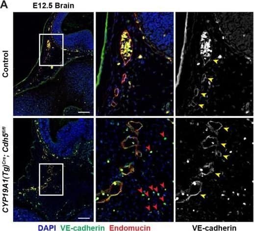 VE-cadherin expression is retained in the vasculature of affected organs in CYP19A1(Tg)Cre; Cdh5fl/fl embryos.(A) Immunofluorescence staining of E12.5 Control and CYP19A1(Tg)Cre; Cdh5fl/fl brains for VE-cadherin (green) and Endomucin (red) at sites of hemorrhage. Images in gray scale are VE-cadherin alone. Red arrowheads point to extravascular autofluorescent erythrocytes. Yellow arrowheads point to VE-cadherin+ vessels. Scale bars = 50 μm. (B) Immunofluorescence staining of E12.5 Control and CYP19A1(Tg)Cre; Cdh5fl/fl hearts for VE-cadherin (green) and Endomucin (red). Images in gray scale are VE-cadherin alone. Red arrowheads point to VE-cadherin+ developing coronary vessels. Yellow arrowheads point to VE-cadherin+ endocardium. Scale bars = 50 μm. (C) Immunofluorescence staining of E12.5 Control and CYP19A1(Tg)Cre; Cdh5fl/fl hearts for VE-cadherin (green), Endomucin (red), and LYVE1 (gray). Images in gray scale represent VE-cadherin pixels colocalized with either LYVE1 (liver) or Endomucin (lungs and thorax). Red arrowheads point to LYVE1+VE-cadherin+ liver sinusoidal vessels. Yellow arrowheads point to Endomucin+VE-cadherin+ lung and thoracic blood vessels. Scale bars = 200 μm. (D) Quantification of fold change in VE-cadherin mean fluorescence intensity in the brain, heart, liver, lungs, and thorax.Figure 1—figure supplement 3—source data 1.Excel file containing quantification for VE-cadherin expression in various organs in Figure 1—figure supplement 3.Excel file containing quantification for VE-cadherin expression in various organs in Figure 1—figure supplement 3. Image collected and cropped by CiteAb from the following open publication (//pubmed.ncbi.nlm.nih.gov/35486098), licensed under a CC-BY license. Not internally tested by R&D Systems.