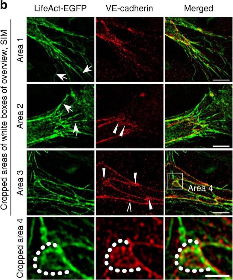 Polarized distribution of VE-cadherin and actin in sprouting ECs in developing mice retinas. a Laser scanning microscopy (LSM) showing an overview of the front area of a whole-mounted P6 transgenic mouse retina expressing LifeAct-EGFP additionally immune stained with anti-VE-cadherin and anti-ERG antibodies; nuclei were stained with anti-ERG. Tip cell (arrowheads) and adjacent stalk cell (arrows) are indicated. Scale bar: 40 µm. b High-resolution SIM of selected areas 1–3, as indicated in the right panel of a. Shown is one z-plane. (Area 1) a characteristic tip cell with large actin-based filopodia and a cytosolic spotted VE-cadherin pattern. (Area 2) A tip cell/stalk cell junction at the cell pole of elongated cells identifies terminating actin filaments (arrow) and an interrupted VE-cadherin pattern (arrowhead). (Area 3) a stalk cell/stalk cell connection. VE-cadherin plaques are indicated at the cell poles (arrowheads) and a linear VE-cadherin pattern (empty arrowhead) at lateral junctions; parallel actin filaments are also visible. Scale bar: 5 µm. (Area 4) The cropped area depicts an actin-positive JAIL (dotted line, LifeAct-EGFP) with VE-cadherin plaques (dotted line, VE-cadherin staining). Scale bar: 2 µm. c P7 rat retina immune labelled with ARPC2 and VE-cadherin show increased ARPC2 at the cell poles (arrows). Scale bars in the left panels and right panels represent 50 and 15 µm, respectively. d Scheme illustrates the iterative dynamics of VE-cadherin interruption and JAIL formation leading to VE-cadherin plaques in sprouting ECs. The VE-cadherin dynamics was particularly pronounced at the cell poles, while the lateral junctions showed moderate dynamics Image collected and cropped by CiteAb from the following open publication (//pubmed.ncbi.nlm.nih.gov/29263363), licensed under a CC-BY license. Not internally tested by R&D Systems.