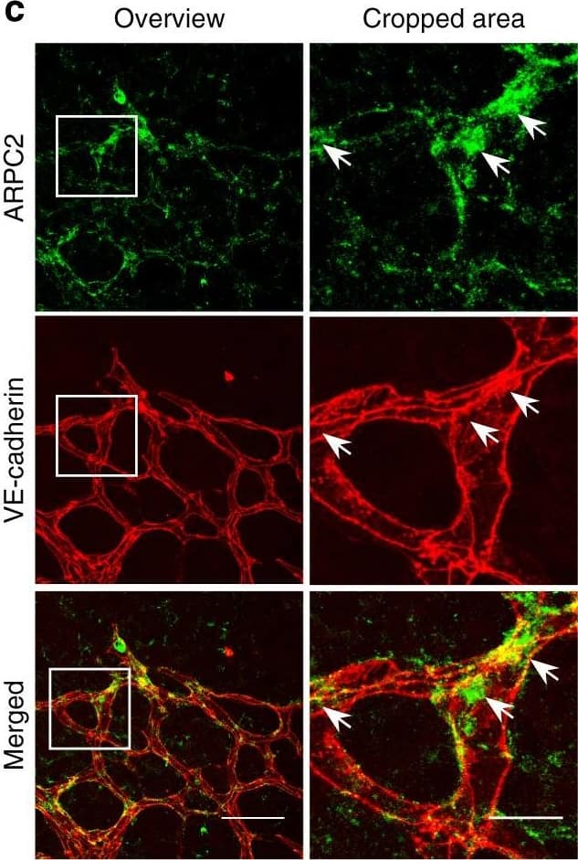 Polarized distribution of VE-cadherin and actin in sprouting ECs in developing mice retinas. a Laser scanning microscopy (LSM) showing an overview of the front area of a whole-mounted P6 transgenic mouse retina expressing LifeAct-EGFP additionally immune stained with anti-VE-cadherin and anti-ERG antibodies; nuclei were stained with anti-ERG. Tip cell (arrowheads) and adjacent stalk cell (arrows) are indicated. Scale bar: 40 µm. b High-resolution SIM of selected areas 1–3, as indicated in the right panel of a. Shown is one z-plane. (Area 1) a characteristic tip cell with large actin-based filopodia and a cytosolic spotted VE-cadherin pattern. (Area 2) A tip cell/stalk cell junction at the cell pole of elongated cells identifies terminating actin filaments (arrow) and an interrupted VE-cadherin pattern (arrowhead). (Area 3) a stalk cell/stalk cell connection. VE-cadherin plaques are indicated at the cell poles (arrowheads) and a linear VE-cadherin pattern (empty arrowhead) at lateral junctions; parallel actin filaments are also visible. Scale bar: 5 µm. (Area 4) The cropped area depicts an actin-positive JAIL (dotted line, LifeAct-EGFP) with VE-cadherin plaques (dotted line, VE-cadherin staining). Scale bar: 2 µm. c P7 rat retina immune labelled with ARPC2 and VE-cadherin show increased ARPC2 at the cell poles (arrows). Scale bars in the left panels and right panels represent 50 and 15 µm, respectively. d Scheme illustrates the iterative dynamics of VE-cadherin interruption and JAIL formation leading to VE-cadherin plaques in sprouting ECs. The VE-cadherin dynamics was particularly pronounced at the cell poles, while the lateral junctions showed moderate dynamics Image collected and cropped by CiteAb from the following open publication (//pubmed.ncbi.nlm.nih.gov/29263363), licensed under a CC-BY license. Not internally tested by R&D Systems.