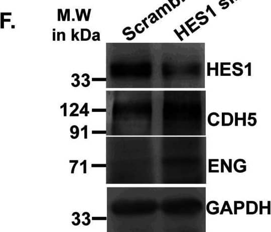 Acquisition of endothelial markers upon trophoblast differentiation is associated with down-regulation in Hes1.(A) Western blot analysis for HES1 and endothelial cell–specific proteins CDH5, PECAM1, and ENG using cell lysates from TS and TC. (A, B) Densitometric analysis of the proteins from blots in (A) using NIH ImageJ software after normalization with GAPDH. (C) Quantitative real-time PCR of Hes1 using RNA from TS cells transfected with either scrambled or Hes1 siRNA. (D, E) Quantitative real-time PCR of Cdh5 (D) and endoglin (E) using RNA from TS cells transfected with either scrambled or Hes1 siRNA. (F) Western blot analysis of HES1, CDH5, PECAM1, and ENG using cell lysates from TS cells transfected with either 100 nM scrambled or Hes1 siRNA followed by induction of differentiation till day 2. (F, G) Densitometric analysis of the proteins from (F) using NIH ImageJ software after normalization with GAPDH. Data are representative of three independent biological replicates. Error bars represent SEM. *P < 0.5, **P < 0.01.Source data are available for this figure. Image collected and cropped by CiteAb from the following open publication (//pubmed.ncbi.nlm.nih.gov/36574992), licensed under a CC-BY license. Not internally tested by R&D Systems.