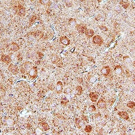 Immunohistochemistry UNC5H2/UNC5B Antibody [Unconjugated]