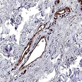 Immunohistochemistry IL1RAPL2 Antibody [Unconjugated]