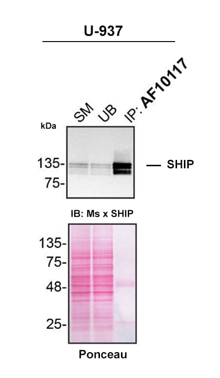 PMA-treated U-937 lysates were prepared and immunoprecipitation was performed using 2.0 µg of Goat Anti-Human/Mouse SHIP Antigen Affinity-purified Polyclonal Antibody (Catalog # AF10117) pre-coupled to Dynabeads protein G. Immunoprecipitated SHIP was detected with Mouse Anti-SHIP Antibody.The Ponceau stained transfer of the blot is shown. SM=4% starting material; UB=4% unbound fraction; IP=immunoprecipitate; HC=antibody heavy chain. Image, protocol and testing courtesy of YCharOS Inc. (ycharos.com).