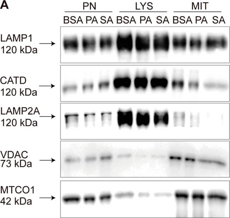 Lysosomal LAMP2A protein levels decrease in POMC-like neurons treated with PA and SA. (A) POMC-like neurons (N43/5) were incubated with 100 mM of PA, SA, or vehicle (BSA) for 6 h and a mitochondrial and lysosomal fractionation was carried out according to Ormeño et al. 2020. Post nuclear (PN), lysosomal (LYS), and mitochondrial (MIT) fractions were evaluated by Western blot using LAMP1, CATD, LAMP2, VDAC, and MTCO1 antibodies, as appropriate. (B) Representative Western blot comparing the lysosomal LAMP2A protein levels versus the PN fractions after BSA, PA, and SA treatment. (C) Quantification of LAMP2A from Figure 2B using ordinary one-way ANOVA (n = 3). n.s. = non-significant, ** = p < 0.01. Image collected and cropped by CiteAb from the following open publication (//pubmed.ncbi.nlm.nih.gov/35326371), licensed under a CC-BY license. Not internally tested by R&D Systems.