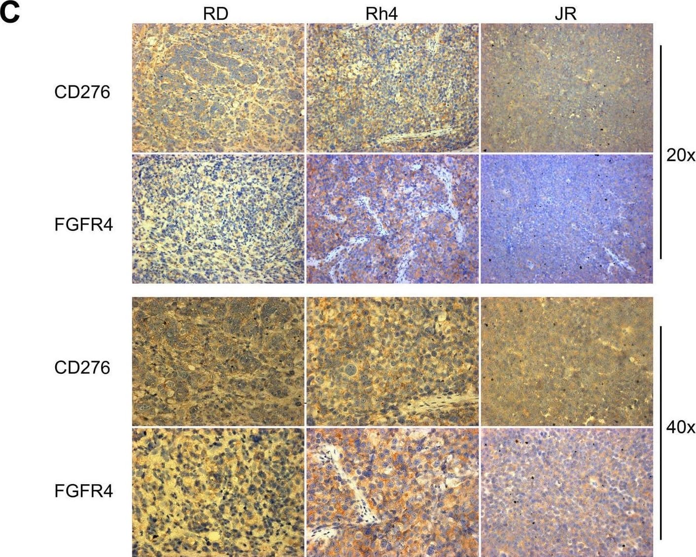 Expression of CD276 and FGFR4 on RMS-derived xenografts. A Expression of CD276 was assessed by Flow Cytometry on untreated Rh4-derived xenograft tumors and compared to cultured wild-type Rh4 cells by using a PE-conjugated anti-CD276 antibody. CD276 expression was calculated dividing the geometric mean of antibody-stained cells by the geometric mean of the controls. CD276 expression showed a lower CD276 expression on Rh4 tumor-derived cells, compared to the cultured Rh4 cells. B Expression of FGFR4 was assessed by Flow Cytometry on Rh4-derived xenograft tumors from untreated mice and compared to cultured wild-type Rh4 cells by using a PE-conjugated anti-FGFR4 antibody. FGFR4 expression was calculated dividing the geometric mean of antibody-stained cells by the geometric mean of the isotype controls. The results indicated a strong decrease in FGFR4 expression in Rh4 tumor xenograft-derived cells. C Assessment of CD276 and FGFR4 expression in tumor xenografts tissue by IHC. After treatment, CD276 is still highly detectable on RD- and Rh4-derived tumor xenografts, but low staining detection was observed in JR-derived tumors. FGFR4 seems expressed at low levels on RD, at medium levels on JR, and at high levels on Rh4 Image collected and cropped by CiteAb from the following open publication (//pubmed.ncbi.nlm.nih.gov/37924157), licensed under a CC-BY license. Not internally tested by R&D Systems.