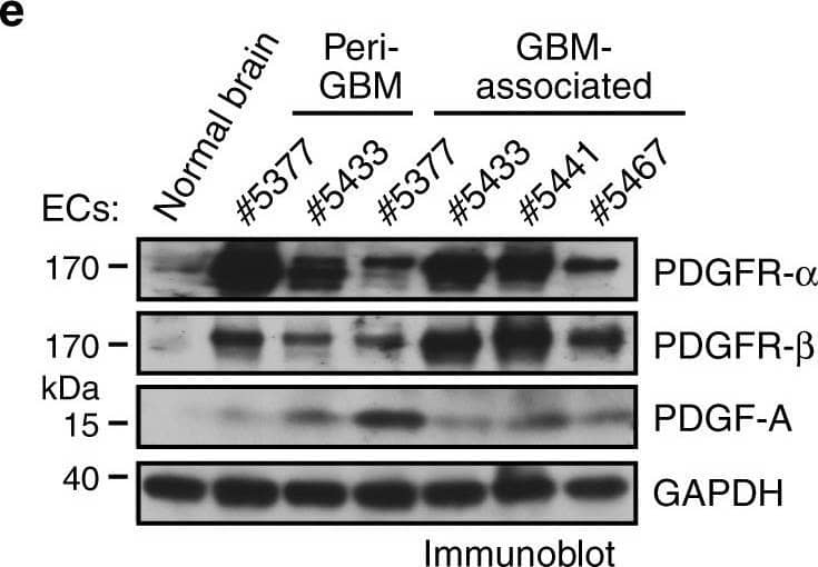 PDGF induces downregulation of VEGFR-2 expression in ECs. a, b Normal human brain microvascular ECs (#1 and #2 from adult brain and #3 from fetal brain) were treated with glioma-conditioned medium (glioma-CM). RNA was isolated and subjected to transcriptome analysis by RNA deep sequencing (RNA-seq). Left, heat map for expression of VEGF receptors. Right, fold changes of VEGFR-1, VEGFR-2, and VEGFR-3 (n = 3, mean ± SEM). b Shown are FPKM values of FSP-1 (n = 3). c Normal brain ECs were treated with glioma-CM or control normal medium. Cell lysates were immunoblotted. d Gene set analysis of upregulated pathways/genes identified by RNA-seq in glioma-CM-treated ECs. e ECs were isolated from GBM tumors or peri-tumor tissues of human patients or normal brains. Cell lysates were immunoblotted. Note: the lyates were also immunoblotted in Fig. 1c, and the same blot for GAPDH was shown. f Normal brain ECs were treated with 100 ng/ml PDGF-AA, PDGF-AB, or PDGF-BB. Cell lysates were immunoblotted Image collected and cropped by CiteAb from the following open publication (//pubmed.ncbi.nlm.nih.gov/30150753), licensed under a CC-BY license. Not internally tested by R&D Systems.