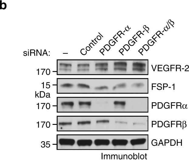 PDGF autocrine loop is critical for VEGFR-2 down-expression and anti-VEGF resistance in GBM-associated ECs. a GBM tumor-derived ECs were treated with control IgG or antibody against PDGF-AA or PDGF-BB. Cell lysates were immunoblotted. b, c GBM tumor-derived ECs were transfected with control scrambled siRNA or siRNA targeting PDGFR-alpha  and PDGFR-beta . b Cell lysates were immunoblotted. c Cell proliferation was determined (n = 3, mean ± SEM). d GBM tumor-derived ECs were treated with Ki8751 and crenolanib at different doses. Cell proliferation was determined 4 days after treatment. Inhibition rates were calculated and expressed as % of control cells Image collected and cropped by CiteAb from the following open publication (//pubmed.ncbi.nlm.nih.gov/30150753), licensed under a CC-BY license. Not internally tested by R&D Systems.