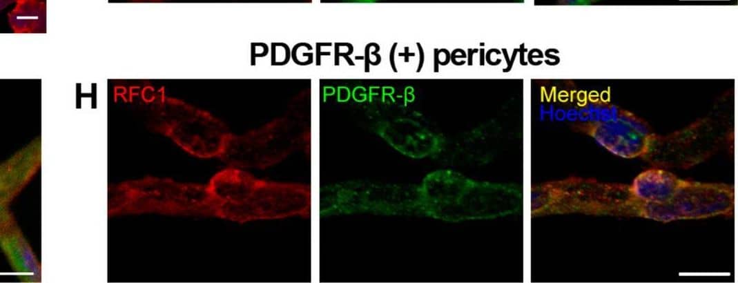 RFC1 protein is abundantly expressed in endothelial cells and pericytes of the retinal microvessels. A Ex-vivo labeling of 20 µm radial cryo-section from PFA fixated eyeballs of naive Swiss Albino mice with anti-RFC1 antibody (red). Abundant RFC1 immunopositivity is observed along ganglion cell layer (GCL), inner plexiform layer (IPL), outer plexiform layer (OPL) where retinal microvessels forms vascular horizontal vascular beds; as well as the retinal pigment epithelium (RPE). However, this preparation limited the observation of microvessels, hence inner BRB, as it commonly included microvessels circularly rather than longitudinally. Scale bar= 25 µm B RPE which is known to express RFC1 previously is well stained with anti-RFC1 antibody (red) as our positive control. C The microvessels constituting inner BRB form the deep vascular plexus of the retina were immunohistochemically labelled with anti-RFC1 antibody in PFA fixated whole-mount retinas. D Retinal microvessels which were obtained via retinal trypsin digestion method that allowed to get only microvessels (< 9 μm diameter) were immunofluorescently labeled with anti-RFC1 antibody (n = 6 retina; red). Nuclei were labeled with Hoechst 33258 (blue) in all the rows. E The endothelial marker CD31 (green) (n = 3). The “bump-on-a log” shaped pericyte body was positively stained with anti-RFC1 antibody, but negative for endothelial marker CD31. Hence, RFC1 staining was specific. F–H RFC1 (red) also colocalized with accepted pericyte markers NG2, CD13, PDGFR-beta  (green) shown respectively (n = 3/marker). Nuclei were labeled with Hoechst 33258 (blue). Scale bars =10 μm Image collected and cropped by CiteAb from the following open publication (//pubmed.ncbi.nlm.nih.gov/37328777), licensed under a CC-BY license. Not internally tested by R&D Systems.