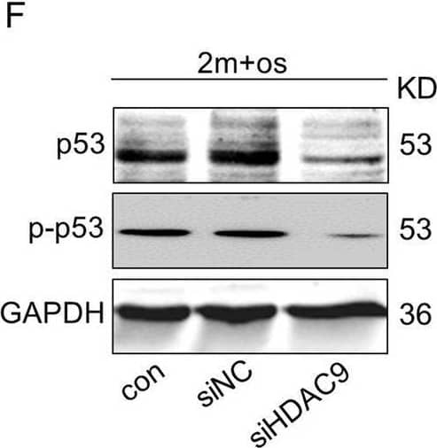 Downregulation of HDAC9 rescued lineage differentiation imbalance and ameliorated senescence in aged BMMSCs. a Alizarin Red staining was performed, and osteogenesis-related proteins were detected by western blotting in aged BMMSCs transfected with HDAC9 siRNA. b Oil Red O staining was performed, and adipogenesis-related proteins were detected by western blotting in aged BMMSCs transfected with HDAC9 siRNA. c Alizarin Red staining was performed, and osteogenic-related proteins were detected by western blotting in young BMMSCs and young BMMSCs transfected with HDAC9 siRNA. d Oil Red O staining was performed, and adipogenic-related proteins were detected by western blotting in young BMMSCs and young BMMSCs transfected with HDAC9 siRNA. e, f Expressions of the senescence-related proteins p53 and p-p53 in BMMSCs cultured in vitro from aged mice (e) and young mice (f) were examined by western blotting. The data are presented as the means ± SD of each independent experiment performed in triplicate. *P < 0.05, **P < 0.01, ***P < 0.001, one-way analysis of variance (ANOVA) Image collected and cropped by CiteAb from the following open publication (//pubmed.ncbi.nlm.nih.gov/32620134), licensed under a CC-BY license. Not internally tested by R&D Systems.