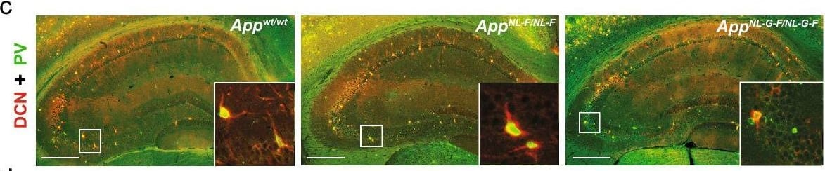 Increased CSF-decorin in three different mouse models of A beta  pathology. a, b Immunostaining and quantification of decorin in the ChP. Scale bars, 100 µm. (n = 4). c Double immunostaining of DCN and PV or d SRIF in mouse hippocampus. e Quantification of decorin-positive cell-type distribution. Scale bars, 500 µm. (n = 3). f, g Immunostaining and quantification of decorin in the hippocampus. Scale bars, 500 µm. (n = 4). h Mouse CSF-decorin levels in three months old (n = 5), i 13 months old (n = 4–5), j 18 months old (n = 3–5) mice were measured by ELISA and quantified. k CSF-decorin levels in AppNL-F/NL-F mice of different ages were measured and quantified. (n = 3–5). l Decorin levels in A beta 42 treated mouse primary neurons and (m) were quantified (n = 4). n Quantification of decorin levels in conditioned media. (n = 8). Data in (b, g–k) were analyzed by one-way ANOVA followed by Dunnett’s multiple comparisons test. Data in (m, n) were analyzed by student’s t-test. Data in (e) were analyzed by two-way ANOVA followed by Tukey’s post hoc test. Data are represented as mean ± SEM; *p < 0.05, **p < 0.01, ***p < 0.001, ****p < 0.0001. DCN decorin, PV parvalbumin, SRIF somatotropin release-inhibiting factor, PN pyramidal neurons, ns not significant Image collected and cropped by CiteAb from the following open publication (//pubmed.ncbi.nlm.nih.gov/35787306), licensed under a CC-BY license. Not internally tested by R&D Systems.