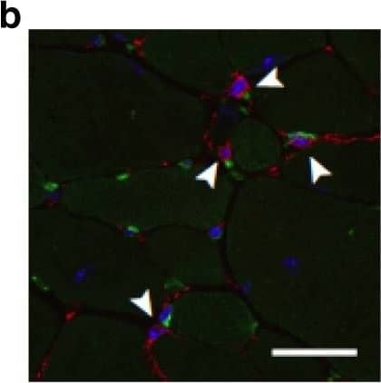 <b>Biological Strategies Validation. </b>Transplantation of CD11b/LIF transgenic BMCs reduces the numbers of FAPs in dystrophic muscle but does not affect phenotype. a QPCR analysis shows that TA muscles from LIF BMT/mdx recipients have reduced Pdgfra gene expression. N = 7 or 8 for WT BMT/mdx and LIF BMT/mdx data sets, respectively, * indicates significantly different from WT BMT/mdx recipients at P < 0.05. P-values based on two-tailed t-test. For all histograms in the figure, the bars indicate mean ± sem. b To quantify the number of FAPs, muscle sections were co-labeled with antibodies to PDGFR alpha  (red) and CD31, CD45 (green). Arrowheads indicate FAPs (CD31-CD45-PDGFR alpha +). Bar = 50 μm. c Fewer FAPs (CD31-CD45-PDGFR alpha +) in TA cross-sections of LIF BMT/mdx recipients compared to WT BMT/mdx recipients. N = 5 for each data set. d There was no detectible change in phenotype of PDGFR alpha + cells assayed for co-expression of the fibrogenic marker HSP47. e FACS plots demonstrating strategy for sorting FAPs (Hoechst + CD11b-CD31-CD45-PDGFR alpha +). Fibroblasts derived from FAPs were stimulated with LIF (10 ng/ml) and/or TGF beta 1 (10 ng/ml) for 3 h (f–h) or 3 days (i–k) and assayed by QPCR for Ctgf (f, i), Fn1 (g, j), and Col1a1 (h, k). N = 4 technical replicates for each data set. Significant findings were verified with biological replicates of cells sorted from independent donors. * Indicates significantly different from control cultures, # indicates significantly different from TGF beta 1 treated cultures, and Φ indicates significantly different from LIF-treated cultures at P < 0.05. P-values based on ANOVA with Tukey’s multiple comparison test. Source data are provided as a Source Data file Image collected and cropped by CiteAb from the following publication (//pubmed.ncbi.nlm.nih.gov/31243277), licensed under a CC-BY license. Not internally tested by R&D Systems.