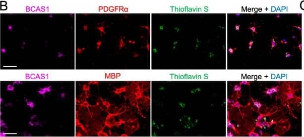 Extracellularly applied recombinant human  alpha -syn PFFs induced cytoplasmic  alpha -syn-immunoreactive inclusions in primary BCAS1(+) cell cultures. a Confocal images of BCAS1(+) cells, which were incubated with 1 μM  alpha -syn PFFs for 24 h from day 4 after differentiation induction, showing the intracellular inclusions labeled with both anti-alpha -syn antibody and thioflavin S. Scale bar = 5 μm. b Immunostaining of oligodendroglial cells incubated with 1 μM  alpha -syn PFFs for 24 h from days 3 (upper) and 4 (lower) after differentiation induction showing the ubiquitous development of thioflavin S-labeled inclusions in PDGFR alpha (+) cells and BCAS1(+) cells. In contrast, few BCAS1(−)/MBP(+) cells developed thioflavin S-labeled inclusions. Scale bar = 50 μm. c The percentages of oligodendroglial cells containing thioflavin S-labeled inclusions were compared between BCAS1(−)/PDGFR alpha (+) cells and BCAS1(+)/PDGFR alpha (+) cells (upper, performed on day 3), and between BCAS1(+)/MBP(+) cells and BCAS1(−)/MBP(+) cells (lower, performed on day 4). N = 4, respectively, independent culture, Mann–Whitney, p* < 0.05 Image collected and cropped by CiteAb from the following publication (//pubmed.ncbi.nlm.nih.gov/32727582), licensed under a CC-BY license. Not internally tested by R&D Systems.