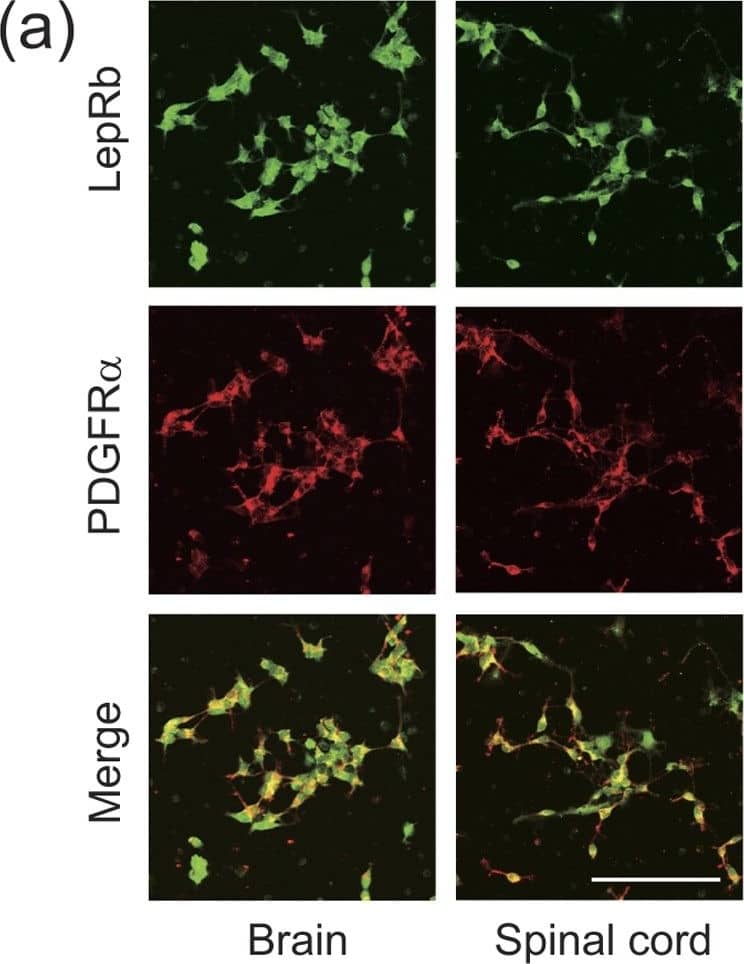 Immunocytochemistry/ Immunofluorescence PDGFR alpha Antibody [Unconjugated]