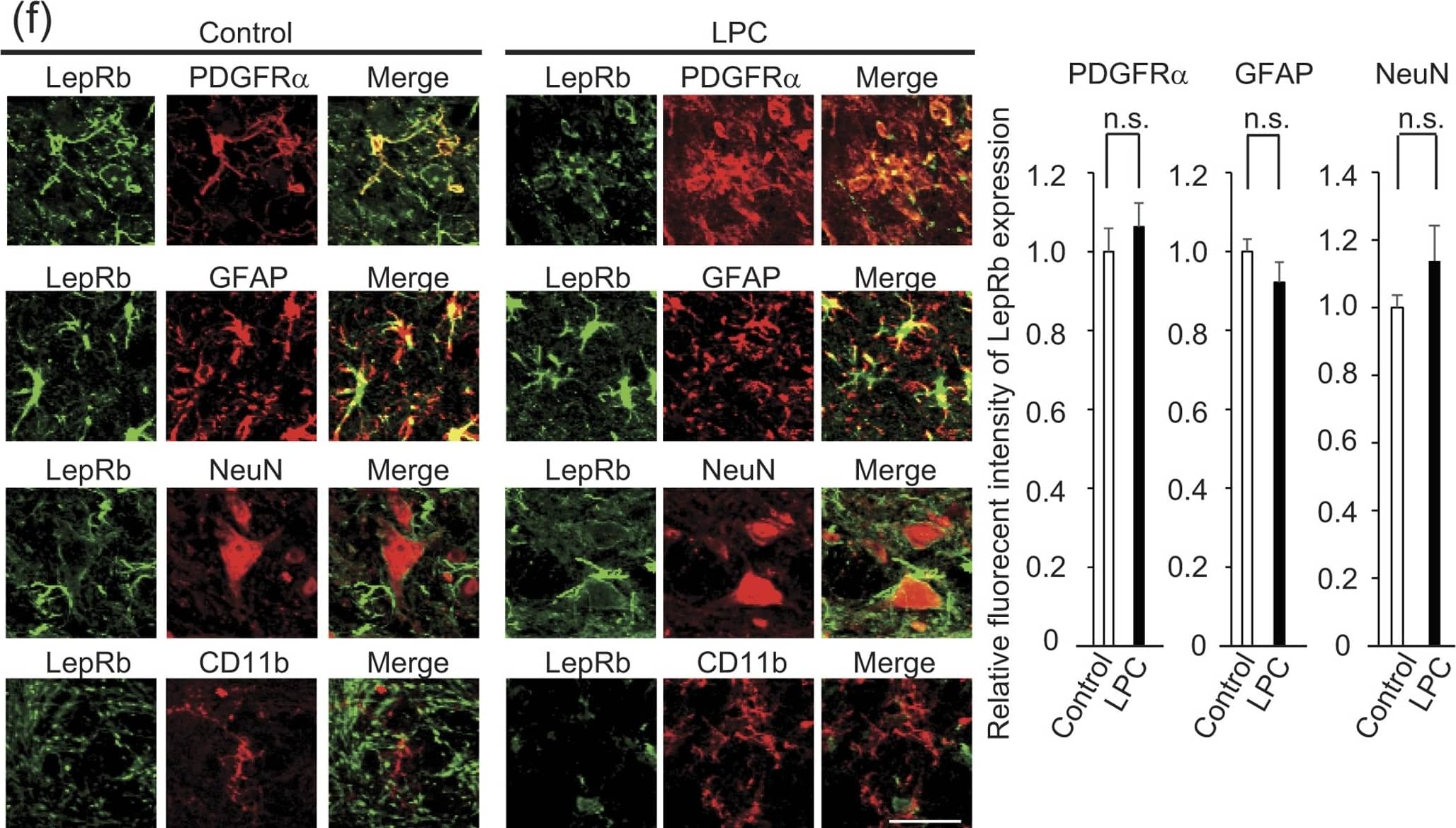 LPC injection does not enhance leptin expression in the CNS.(a) Representative images of MBP expression in a mouse spinal cord 14 days after LPC injection are shown; the graph shows quantification of the demyelinating area in the dorsal spinal cord (n = 3–4). P = 0.001542, Student’s t-test. (b) Representative images of NeuN expression in a mouse spinal cord 14 days after LPC injection; the graph shows quantification of the density of NeuN-positive cells in the spinal cord (n = 3). P = 0.299940, Student’s t-test, n.s. indicates no significant difference. (c) Quantification of leptin protein expression in indicated organs. Tissues were obtained from the mice 3 days after LPC injection (n = 3 for control, 4 for LPC injection). P = 0.318966 (adipose tissue), 0.10446 (brain stem), 0.332281 (cerebellum), 0.345245 (liver), 0.453104 (kidney), 0.098135 (heart), 0.335722 (lung), 0.236771 (muscle), 0.44662 (spleen), 0.465966 (stomach). Student’s t-test. n.s. indicates no significant difference. (d) Quantification of spinal cord leptin protein 3 days after LPC injection (n = 3 for control, 4 for LPC injection). P = 0.026865, Student’s t-test. (e) Quantification of spinal cord leptin mRNA 3 days after LPC injection (n = 6). P = 0.324930, Student’s t-test, n.s. indicates no significant difference. (f) Representative images of LepRb (green) expression in combination with PDGFR alpha , GFAP NeuN, and CD11b (red) in the mouse spinal cord with or without LPC injection. Spinal cord sections were obtained 3 days after LPC injection. Graph indicates the relative intensity of leptin protein expression in indicated cell type (n = 3). P = 0.287452 (PDGFR alpha ), 0.181059 (GFAP), 0.199972 (NeuN), Student’s t-test, n.s. indicates no significant difference. *P < 0.05, **P < 0.01, error bars represent SEM. Scale bars; 100 μm for (a and b), 25 μm for (f). Image collected and cropped by CiteAb from the following publication (//www.nature.com/articles/srep40397), licensed under a CC-BY license. Not in