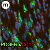 PDGFR alpha  driven brain tumors display features of high grade glioma.(a–g) Histopathological analysis of tumor areas by H&E staining shows a high concentration of mitotic figures (a, arrows), high cellularity and nuclear atypia (b), perineuronal satellitosis (c; N, neuronal nuclei), perivascular growth (d), intrafascicular growth (e), subarachnoid spreading (f), and areas of incipient necrosis (g; arrows point to pyknotic nuclei). (h–k) IF labeling of brain tumor sections for cell type specific markers. Nuclei labeled with DAPI are shown in blue. Tumor cells with high PDGFR alpha  expression were highly proliferative, as seen by proliferation marker Ki67 (h), and express the OPC cell lineage markers Olig2, Sox2, Sox10, and Ng2, as well as the neural stem cell marker Nestin (i–k). Tumor cells were negative for immunosignal of astroglial marker GFAP, mature oligodendrocyte marker APC-CC1, and neuronal marker NeuN (l–n). Scale bars: 10 μm (a–g), 20 μm (h–n). Image collected and cropped by CiteAb from the following publication (//pubmed.ncbi.nlm.nih.gov/25683249), licensed under a CC-BY license. Not internally tested by R&D Systems.