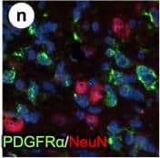 PDGFR alpha  driven brain tumors display features of high grade glioma.(a–g) Histopathological analysis of tumor areas by H&E staining shows a high concentration of mitotic figures (a, arrows), high cellularity and nuclear atypia (b), perineuronal satellitosis (c; N, neuronal nuclei), perivascular growth (d), intrafascicular growth (e), subarachnoid spreading (f), and areas of incipient necrosis (g; arrows point to pyknotic nuclei). (h–k) IF labeling of brain tumor sections for cell type specific markers. Nuclei labeled with DAPI are shown in blue. Tumor cells with high PDGFR alpha  expression were highly proliferative, as seen by proliferation marker Ki67 (h), and express the OPC cell lineage markers Olig2, Sox2, Sox10, and Ng2, as well as the neural stem cell marker Nestin (i–k). Tumor cells were negative for immunosignal of astroglial marker GFAP, mature oligodendrocyte marker APC-CC1, and neuronal marker NeuN (l–n). Scale bars: 10 μm (a–g), 20 μm (h–n). Image collected and cropped by CiteAb from the following publication (//pubmed.ncbi.nlm.nih.gov/25683249), licensed under a CC-BY license. Not internally tested by R&D Systems.