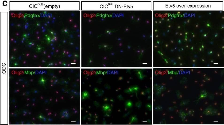 Etv5 is necessary and sufficient for proliferation and cell fate bias downstream of Cic loss. Cic-null mouse NSCs (CicnullEmpty), Cic-null mouse NSCs with dominant negative Etv5 (CicnullDN-Etv5), and Cic-wildtype mouse NSCs overexpressing Etv5 (Etv5 overpression) were grown in lineage-directed culture conditions and assessed for their ability to differentiate to oligodendrocytes as determined by immunostaining for Olig2, Pdgfra, and Mbp. Scale bar: 10?µm. Image collected and cropped by CiteAb from the following publication (//pubmed.ncbi.nlm.nih.gov/31043608), licensed under a CC-BY licence.