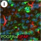 PDGFR alpha  driven brain tumors display features of high grade glioma.(a–g) Histopathological analysis of tumor areas by H&E staining shows a high concentration of mitotic figures (a, arrows), high cellularity and nuclear atypia (b), perineuronal satellitosis (c; N, neuronal nuclei), perivascular growth (d), intrafascicular growth (e), subarachnoid spreading (f), and areas of incipient necrosis (g; arrows point to pyknotic nuclei). (h–k) IF labeling of brain tumor sections for cell type specific markers. Nuclei labeled with DAPI are shown in blue. Tumor cells with high PDGFR alpha  expression were highly proliferative, as seen by proliferation marker Ki67 (h), and express the OPC cell lineage markers Olig2, Sox2, Sox10, and Ng2, as well as the neural stem cell marker Nestin (i–k). Tumor cells were negative for immunosignal of astroglial marker GFAP, mature oligodendrocyte marker APC-CC1, and neuronal marker NeuN (l–n). Scale bars: 10 μm (a–g), 20 μm (h–n). Image collected and cropped by CiteAb from the following publication (//pubmed.ncbi.nlm.nih.gov/25683249), licensed under a CC-BY license. Not internally tested by R&D Systems.