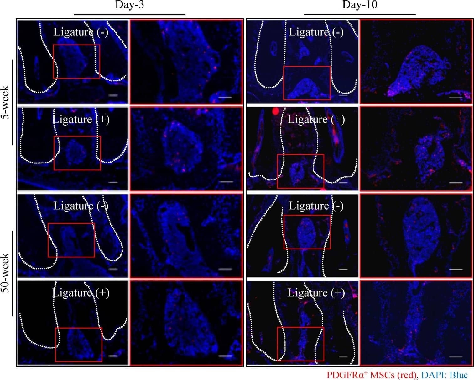 Reduced number of MSCs at the periodontitis site in aged mice. Immunofluorescence images show the number of platelet-derived growth factor receptor  alpha  (PDGFR alpha )+ MSCs (red) in the furcation area in young and aged mice. Cell nuclei were stained with DAPI (blue). Bar: 100 µm. The graph shows the quantitative analysis indicating that the number of PDGFR alpha + Mesenchymal stem cells (MSCs) is decreased in aged mice, more prominently at day-10 after ligation. The bar graph represents the mean ± standard deviation of at least three independent samples. * p < 0.05, ** p < 0.01, *** p < 0.001, two-way ANOVA, Tukey test (n = 3). Image collected and cropped by CiteAb from the following open publication (//pubmed.ncbi.nlm.nih.gov/33143068), licensed under a CC-BY license. Not internally tested by R&D Systems.