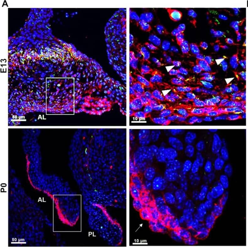 PDGFR alpha  and ciliary axonemes early in development. (A) High-resolution microscopy and (B,C) 3D IHC reconstructions of 15 µm wildtype tissue show phosphorylated PDGFR alpha  (red) present along ciliary axonemes (acetylated tubulin, green) (arrowheads highlighted in C) at E13. By P0, the receptor localizes to the endocardium where cilia are absent (arrows). Image collected and cropped by CiteAb from the following open publication (//pubmed.ncbi.nlm.nih.gov/33805717), licensed under a CC-BY license. Not internally tested by R&D Systems.