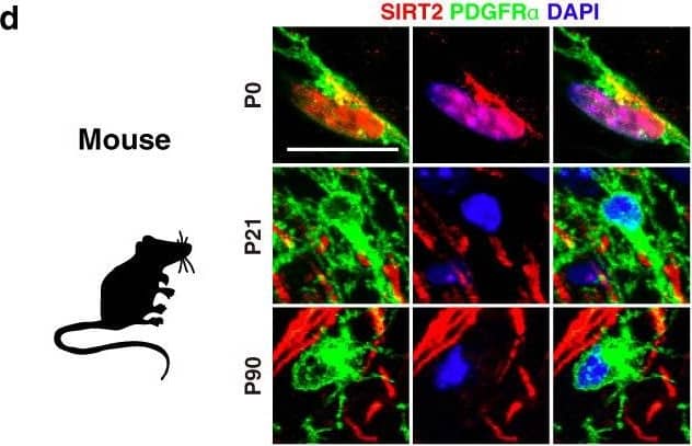 Nuclear entry of SIRT2 in OPCs during remyelination is impaired in the aged mice in vivo.a Primary culture of various types of cells from P0 rat cortex. b qRT-PCR of seven members of sirtuins in primary cultured OPCs and mature oligodendrocytes from the cortex of P0 rat (n = 3). c qRT-PCR of sirt2 in primary cultured various types of cells from the cortex of P0 rat (n = 3). d–f Immunofluorescence and quantification of SIRT2+ cells in the cortex of mice at different ages (n = 3). Scale bar, 10 μm (d), 50 μm (upper panel images of f), 5 μm (lower panel images of f). g–h Immunofluorescence of SIRT2 in the cortex of marmosets at postnatal day 3 (P3, g) or age of 8 years (h). Scale bar, 50 μm. i Immunohistochemistry of SIRT2 in the cortex of human at age of 53 years. Scale bar, 20 μm. j, k Relative SIRT2 protein level in brains of WT young (6 M) and old (18 M) mice (n = 3). l–o Immunofluorescence and quantification of SIRT2+ OPCs and nuclear SIRT2+ OPCs in corpus callosum of WT young and old mice (n = 3). NL, non-lesion, L, demyelination lesion induced by LPC at 5 dpl. Scale bar, 10 μm. All data are presented as mean ± SEM. *p < 0.05, **p < 0.01, ***p < 0.001 by two-tailed t-test (k) or one-way ANOVA followed by Tukey’s post hoc test (m–o). In all instances ***p  <  0.001. n.s. no significance. In (k), **p = 0.004; in (m), **p = 0.002 (L-Young vs. L-Old); in (n), **p = 0.007 (L-Young vs. L-Old). Image collected and cropped by CiteAb from the following open publication (//pubmed.ncbi.nlm.nih.gov/35264567), licensed under a CC-BY license. Not internally tested by R&D Systems.