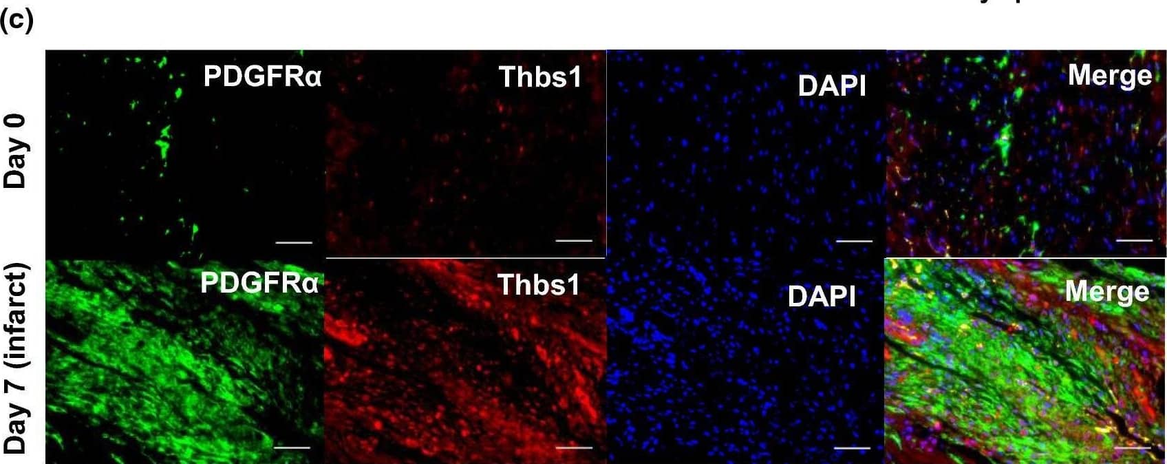 MI day 7 fibroblasts showed an anti-angiogenic myofibroblast phenotype profile. a Volcano plot and major upregulated processes. bThbs1 expression was significantly increased; n = 3 per group. c LV infarct region from MI day 7 stained for cardiac fibroblast marker PDGFR alpha  (green), Thbs1 (red), and DAPI (blue). Thbs1 was significantly increased within regions staining positive for PDGFR alpha ; n = 4 day 0, n = 5 MI day 7. d Immunoblot analysis of Thbs1 in cardiac fibroblast secretome. MI significantly increased cardiac fibroblast secretion of Thbs1 at MI day 7; n = 3 per group; densitometry normalized to total membrane stain. *p < 0.05 versus day 0; $p < 0.05 versus MI day 3 Image collected and cropped by CiteAb from the following open publication (//pubmed.ncbi.nlm.nih.gov/30635789), licensed under a CC-BY license. Not internally tested by R&D Systems.