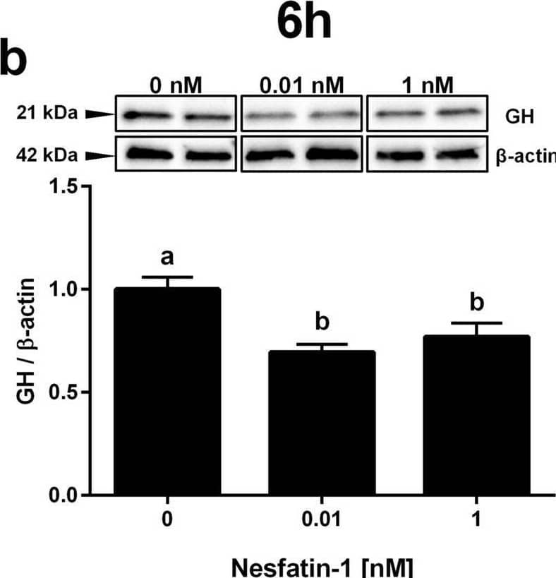 NESF or NLP treatment decreases GH protein in mammalian somatotroph cells. Effects of 1 h incubation with NESF (a) or NLP (c), or of 6 h incubation (b and d, respectively), on the GH protein levels in GH3 cells detected by Western blot. Representative immunoreactive bands and quantification of GH band intensity. Four independent experiments with triplicates (n = 3 wells/treatment/experiment) were performed for each study. Data from all four experiments were pooled to conduct statistical analyses and are shown as mean ± SEM (n = 12 wells) normalized to the levels of  beta -actin and presented as a fold change over Control. Different letters indicate significant differences (p < 0.05) between the different concentrations detected by one-way ANOVA test followed by Tukey’s multiple comparison test. Image collected and cropped by CiteAb from the following open publication (//pubmed.ncbi.nlm.nih.gov/33028951), licensed under a CC-BY license. Not internally tested by R&D Systems.