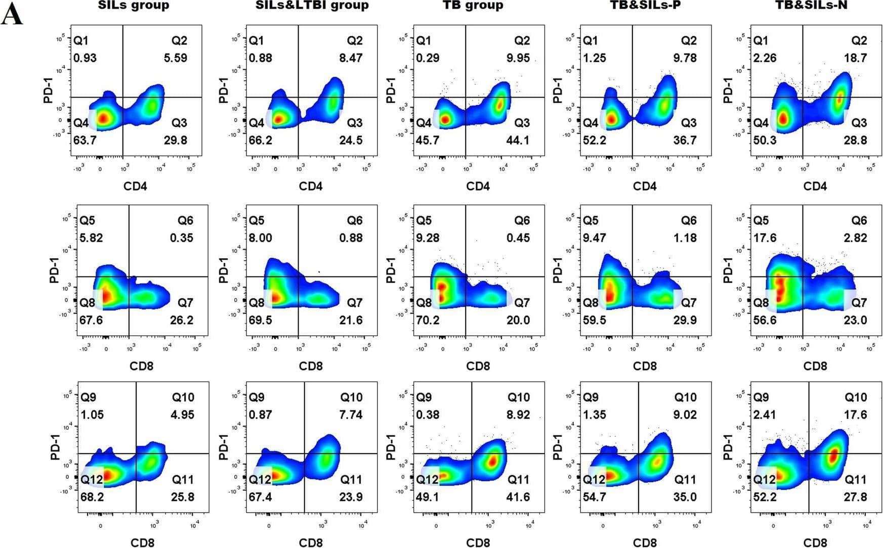The expression of PD-1 on CD4+T cells CD8+T cells and CD56+NK cells in silicosis. a Gating strategy and expression profiles of PD-1 in peripheral CD4+T cells CD8+T cells and CD56+NK cells in TB group, SILs group, SILs&LTBI group TB&SILs-P group and TB&SILs-N group. b The expression of PD-1 on CD4+T cells in TB group, SILs group, SILs&LTBI group TB&SILs-P group and TB&SILs-N group; c The expression of PD-1 on CD8+T cells in TB group, SILs group, SILs&LTBI group TB&SILs-P group and TB&SILs-N group; d The expression of PD-1 on CD56+NK cells in TB group, SILs group, SILs&LTBI group TB&SILs-P group and TB&SILs-N group; e Analyzed the correlation between the level of IFN-gamma  and expression of PD-1 on CD4+T cells; f Analyzed the correlation between the level of IFN-gamma  and expression of PD-1 on CD8+T cells; g Analyzed the correlation between the level of IFN-gamma  and expression of PD-1 on CD56+NK cells. *p < 0.05; **p < 0.01; ***p < 0.001 Image collected and cropped by CiteAb from the following open publication (//pubmed.ncbi.nlm.nih.gov/36587204), licensed under a CC-BY license. Not internally tested by R&D Systems.
